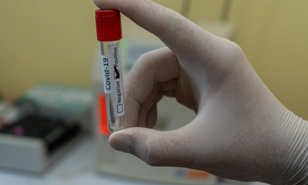 Testosteroncypionaat bij vrouwen: virilisatierisico’s